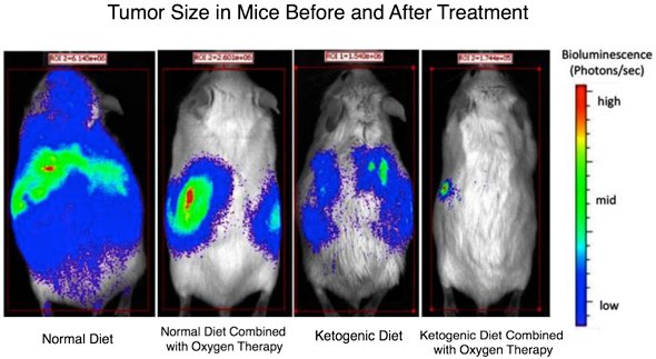 A chart from the research showing cancerous cells dying out under a ketogenic diet.